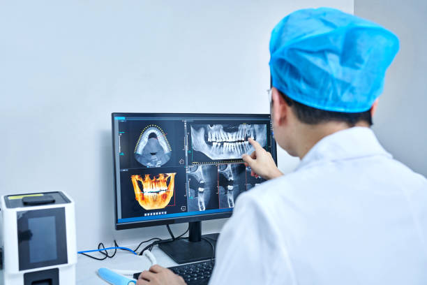 Best Emergency Dentist for Lost Fillings or Crowns in Fishers, IN